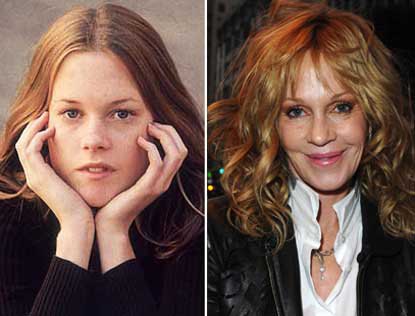 melanie-griffith-plastic-surgery-by-50